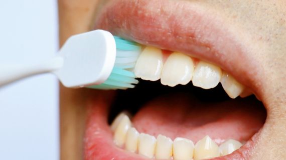 31/03/2026 – Curaden Workshop and iTop Patient Oral Care Principles