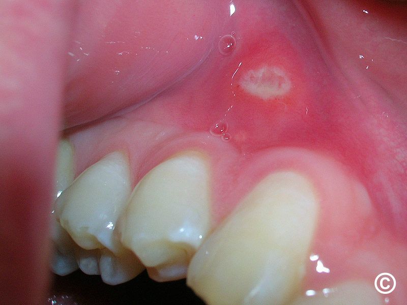 09/06/2026 – APLAN 3 Case Presentation – Oral Lesions in Practice