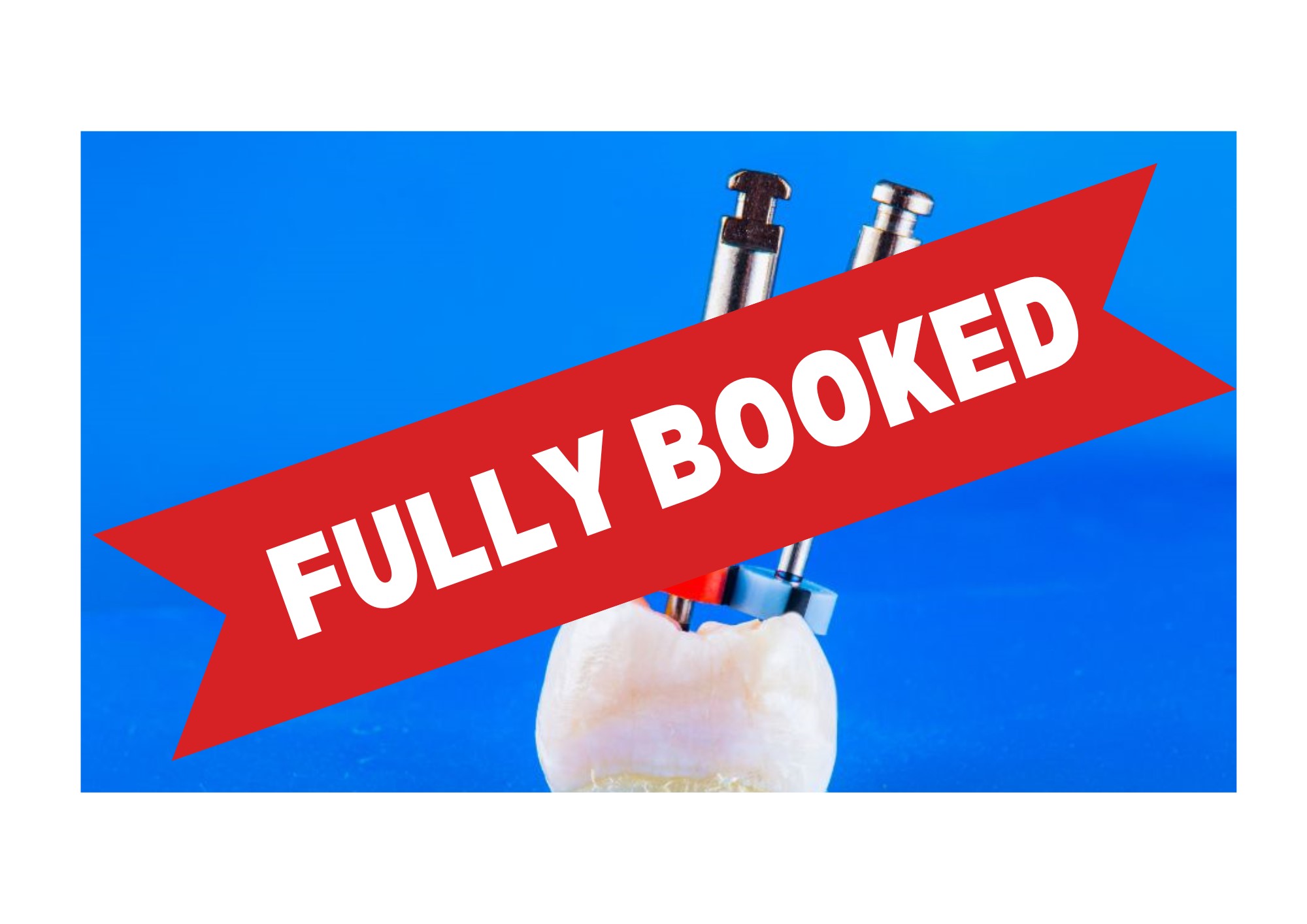 27/03/2026 – The ABC’s of Root Canal Treatment