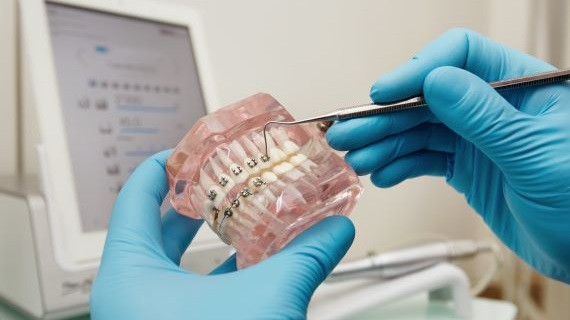 23/10/2025 – Bonded Retainers for Orthodontic Therapists