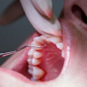 Perio hands on course - Dentist