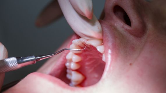 13/11/2025 – Periodontology Hands-on Course