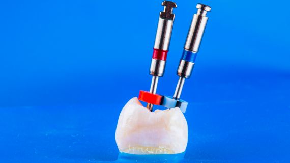 27/03/2026 – The ABC’s of Root Canal Treatment