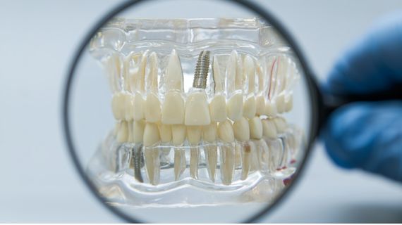 25/11/2026 – Implant Maintenance in General Practice